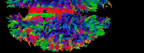 Por qué a tu cerebro le encanta contar historias